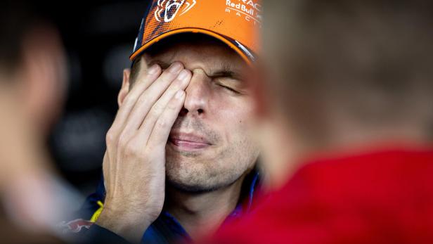 Max Verstappen kratzt sich am Auge.